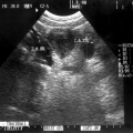 DuoFertility Baby